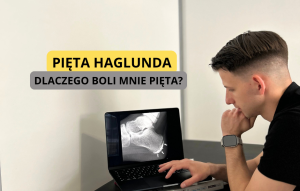 pięta haglunda