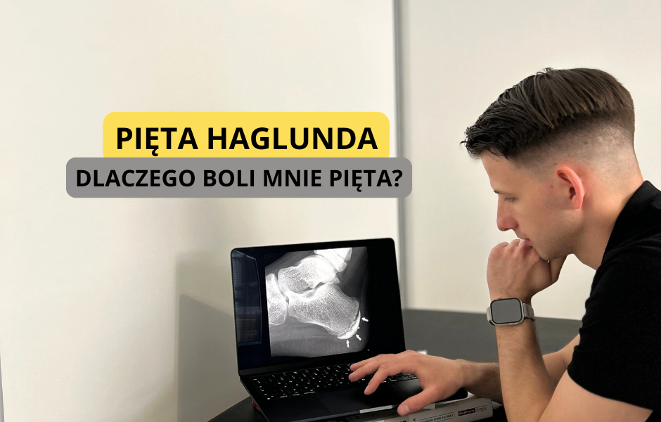 pięta haglunda