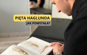 pięta haglunda
