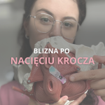 BLIZNA PO NACIĘCIU KROCZA