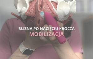 BLIZNA PO NACIĘCIU KROCZA