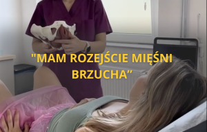 rozejście mięśni prostych brzucha